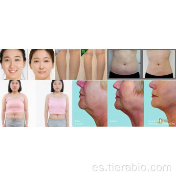 Dermeca Meso Meso disuelto inyección 5ml vial lipólisis